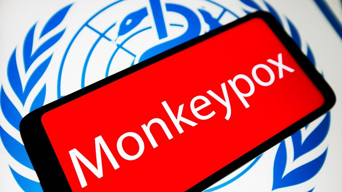 Opičí neštovice se šíří Evropou, první případ hlásí Švýcarsko